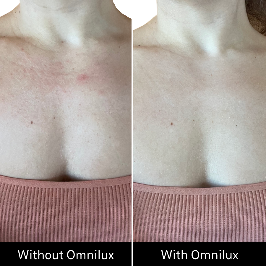 Omnilux Contour Neck & Décolleté LED Light Therapy Mask